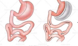 袖状胃术后吃瓜,健康与美味的平衡之道